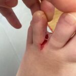 New Year, New Crinjury
