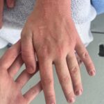 New Mystery Diagnosis!