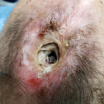 Can I Pick Your Brain?