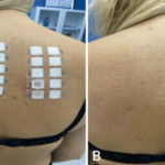 Vag Itch article_river_c3ceee30549a11ef852c032ac4a8cd6d-Fig.-3