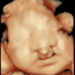 article_river_f54a3a80d79b11ef99c9715972b175f4-Figure1