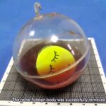 Man-gets-flashing-toy-ball-stuck-up-his-anus