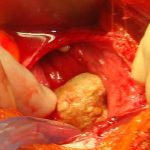 10.1089_whr.2022.0099-fig1